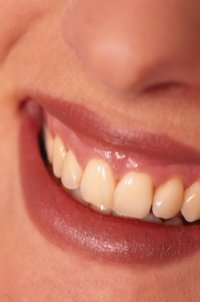 Почему зубы у женщин портятся еще резвее, чем у парней