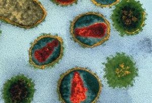 Ученые нашли ген, снижающий опасность ВИЧ