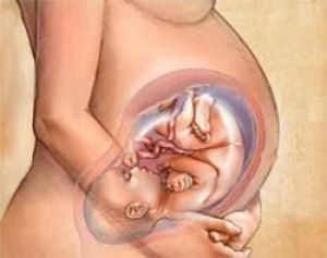 Кесарево сечение – легче для матери, но опасны для малыша