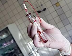 Учёным удалось одолеть неизлечимое болезнь крови