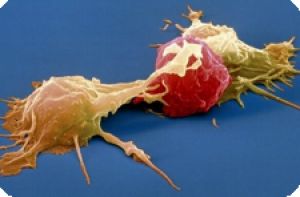 Белок TAK1 помогает предотвращать рак печени