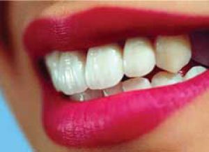 Прекрасные зубы — подходящий стиль