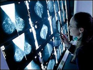 Ученые отыскали мутации генов, приводящие к раку груди
