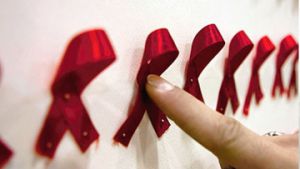 Половой путь инфецирования ВИЧ можно перекрыть