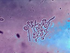 Узнаваемый грибок Candida albicans приобретает резистентность