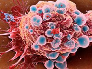 Революционная теория: раковые опухоли - живы организмы 