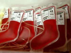 Переливание старенькой крови угрожает суровыми отягощениями