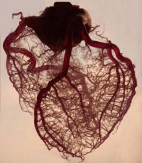 Ученые забраковали сердца белоснежных: они более подвержены аритмии