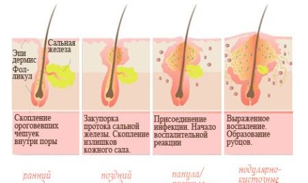 Для правильного исцеления принципиально различать, с какой неприятностью мы имеем дело!