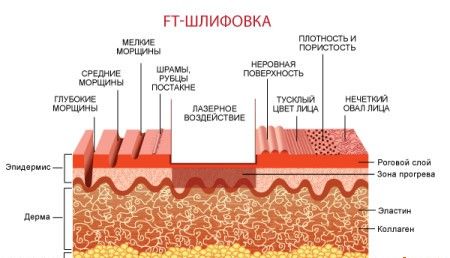 Вот всего только некоторые нюансы внедрения!